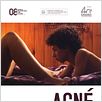 Acné : cartel